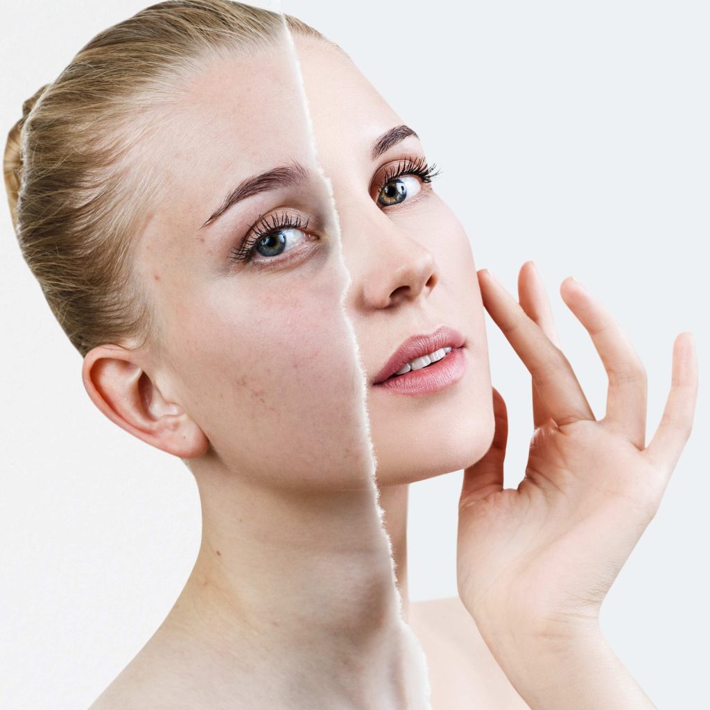 main effects of topical retinol on the skin