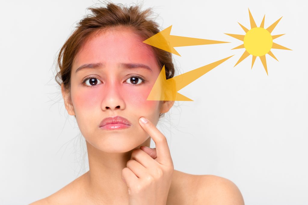 sunscreen mistakes