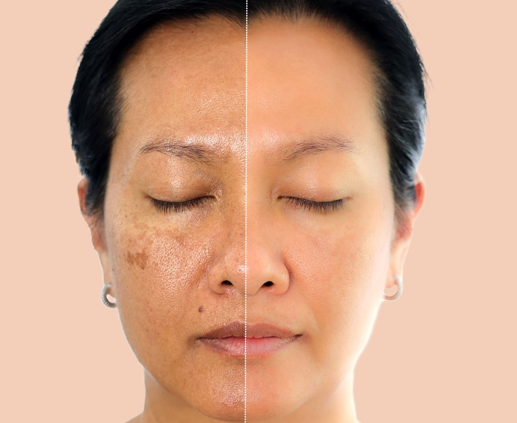 Peptides for skin