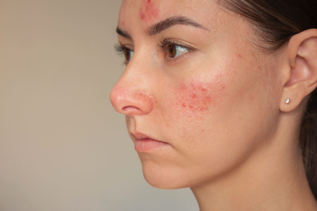 Peptides for skin
