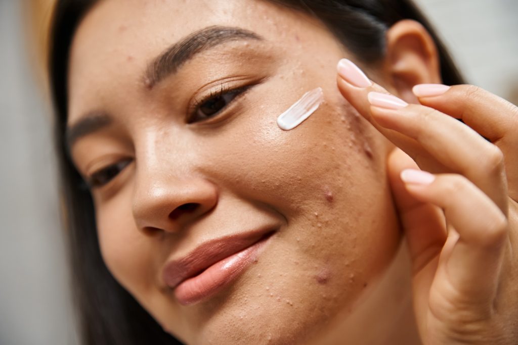 zinc for skin