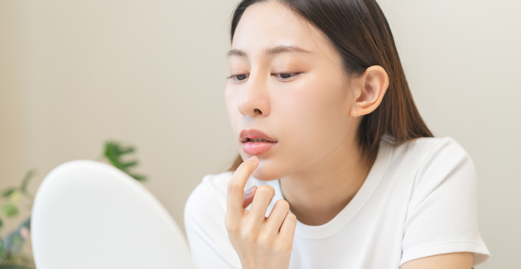 is vaseline good for chapped lips