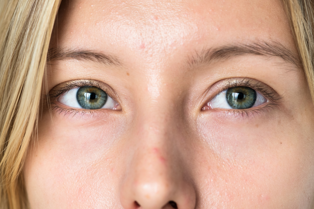 if you have dark circles how to pick the best eye cream dermatologist