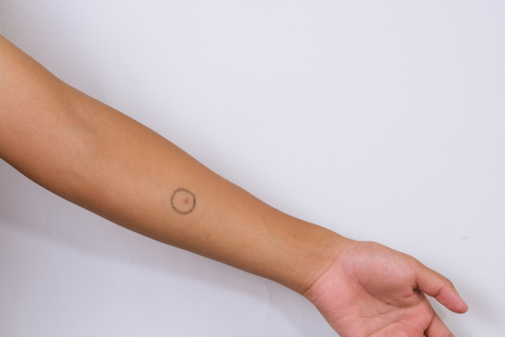 circled area for skin product test