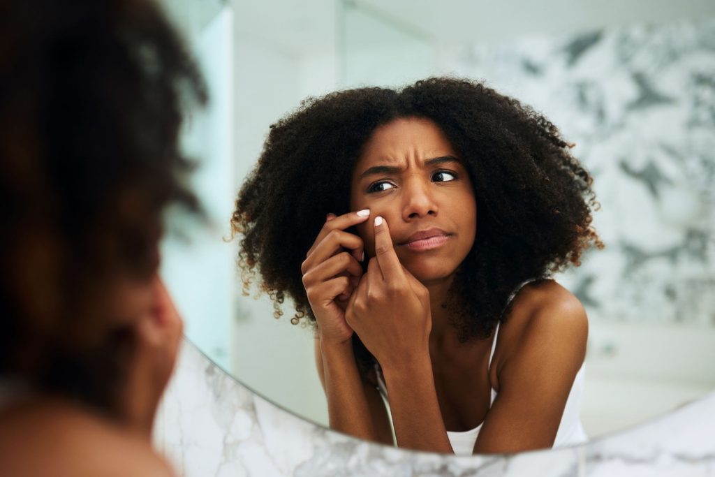 what are sebaceous filaments