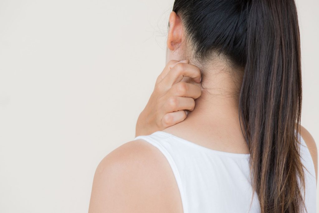 hypochlorous acid eases itching in eczema