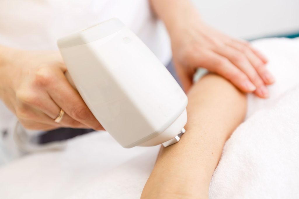 keratosis pilaris and laser therapy